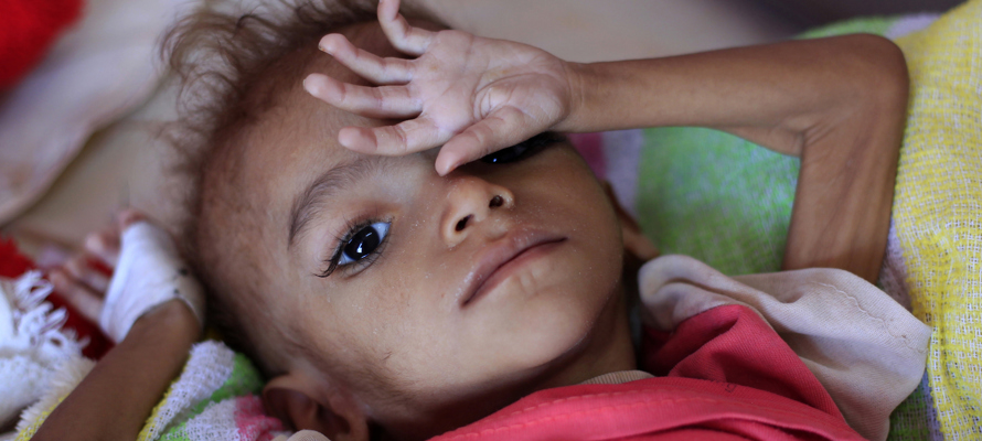 400 000 enfants yéménites risquent de mourir de malnutrition en 2021