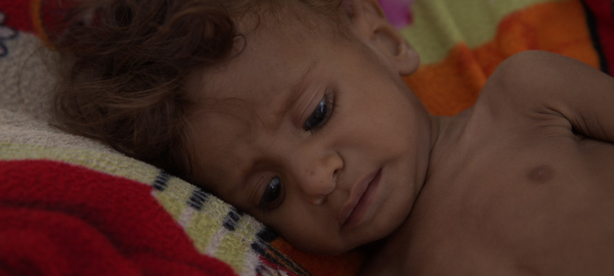 Yémen : Un pays rongé par la crise sanitaire 